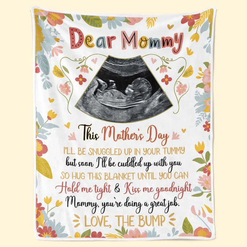 Custom Photo Every Baby Is A Little Miracle - Family Personalized Custom Blanket - Mother's Day, Baby Shower Gift, Gift For First Mom