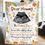 Custom Photo Every Baby Is A Little Miracle - Family Personalized Custom Blanket - Mother's Day, Baby Shower Gift, Gift For First Mom